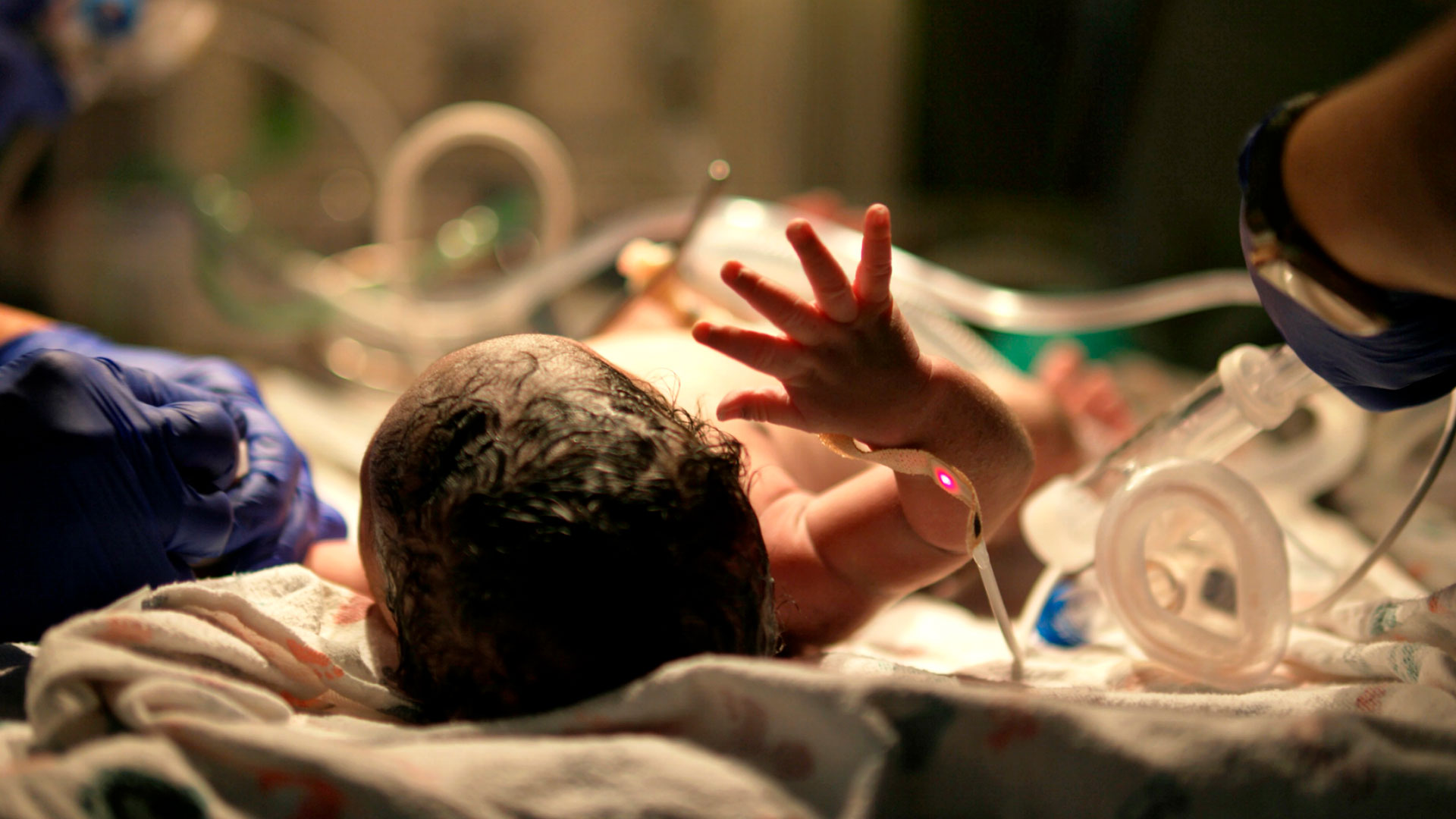 Life-Saving Operation: The Technological Revolution in Neonatal ICUs